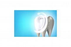 Pro Teeth Whitening Creative Promo Banner Vector Product Image 1