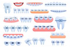 Tooth braces icons set, cartoon style Product Image 1