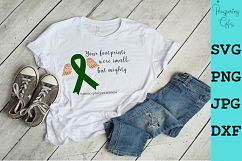 Anencephaly Awareness Product Image 4