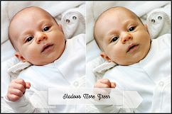 Variations Profiles LR7.3 ACR10.3 Product Image 17