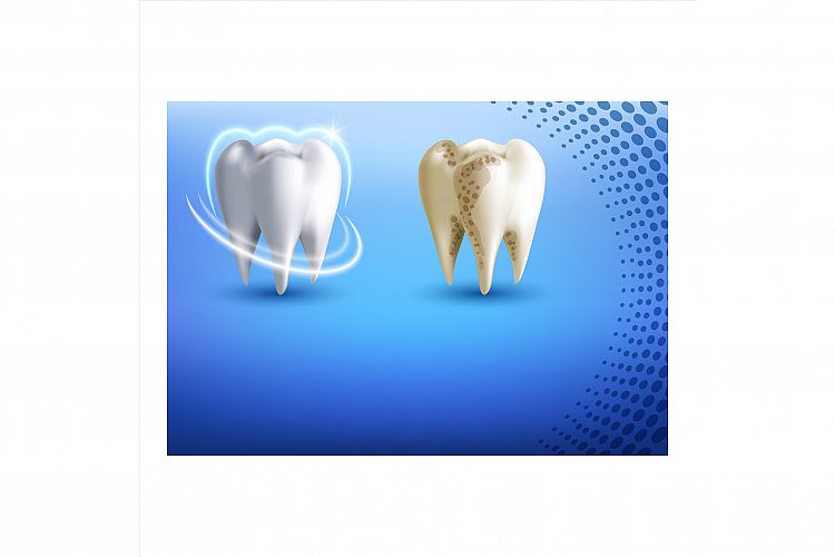 Teeth Clipart Image 16