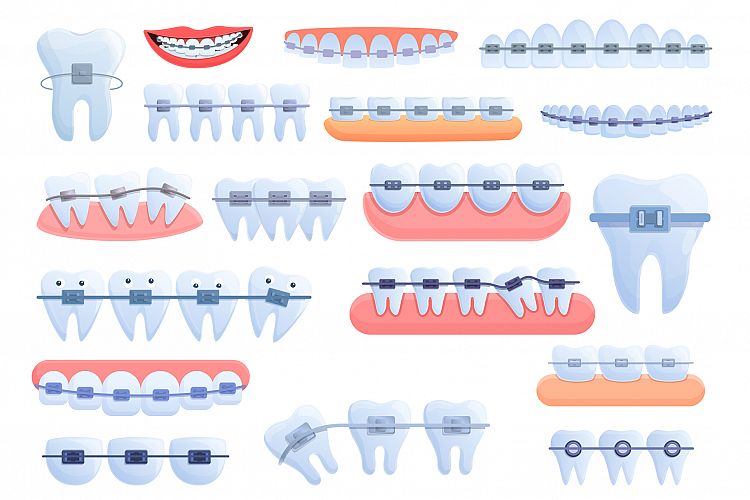 Tooth braces icons set, cartoon style example image 1