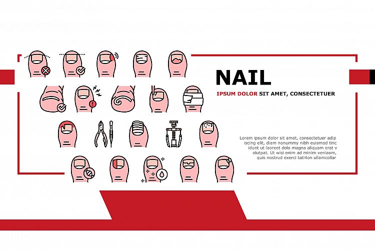 Ingrown Nail Disease Landing Header Vector example image 1