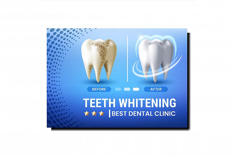 Teeth Whitening Creative Promotional Poster Vector example image 1