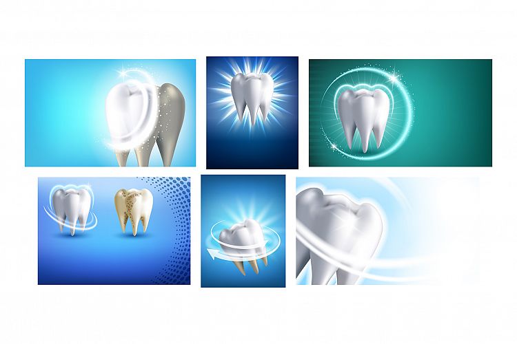 Teeth Whitening Promotional Posters Set Vector example image 1