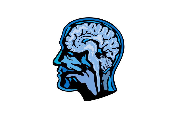 Brain Scanning Imaging Side example image 1
