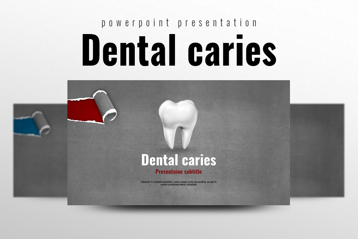 Dental Caries PPT example image 1