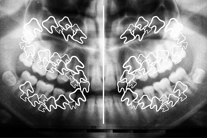 Teeth Font - Alphabets Tooth Font for Crafters